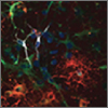 " Fractalkine Promotes Oligodendrocytic Differentiation of Cultured Gliogenic Precursors" Fractalkine Promotes Oligodendrocytic Differentiation of Cultured Gliogenic Precursors