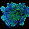 "Exciting Science and Trending Topics from ISSCR 2017" Exciting Science and Trending Topics from ISSCR 2017