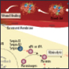 "Poster of Atherosclerosis Disease Progression" Poster of Atherosclerosis Disease Progression
