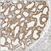 New Methods for iPSC Differentiation, Inducing a Mammary Fate