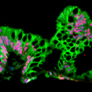 Unfold Your Organoids with MimEX Tissue Model Systems!