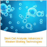 New eBook! Stem Cell Analysis Advancements for Western Blotting