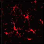 Microglia Promote Alzheimer's During inflammation