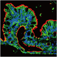 Unfold Your Organoids with MimEX™ Tissue Model System