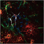 Simplify Staining of Differentiated Neurons with our 3-color ICC Kit!