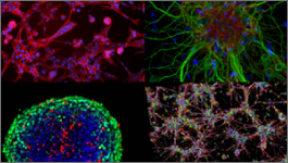 Formation of 3-D, functional neuronal networks in vitro